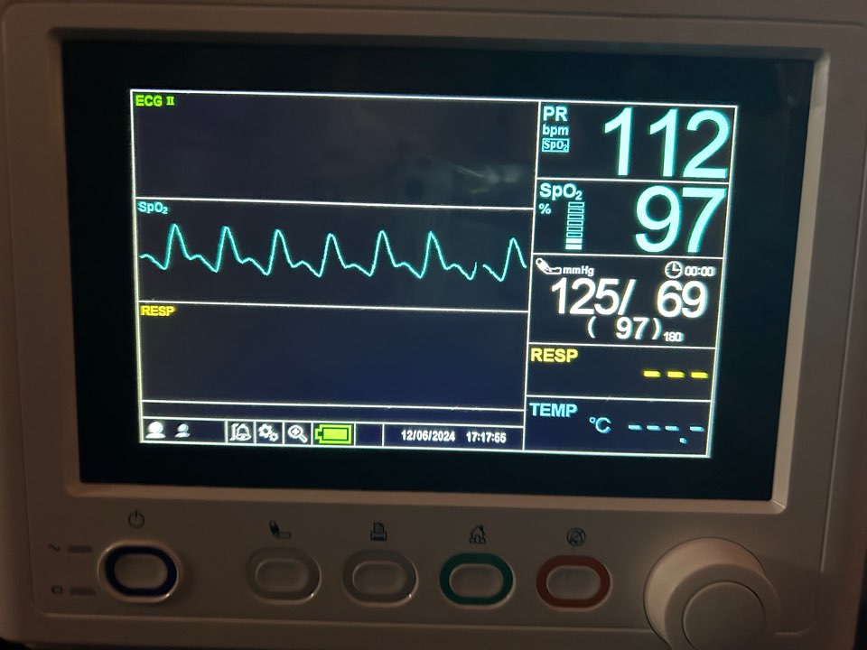 다발성외상환자 싱가포르에서 한국으로 이송완료