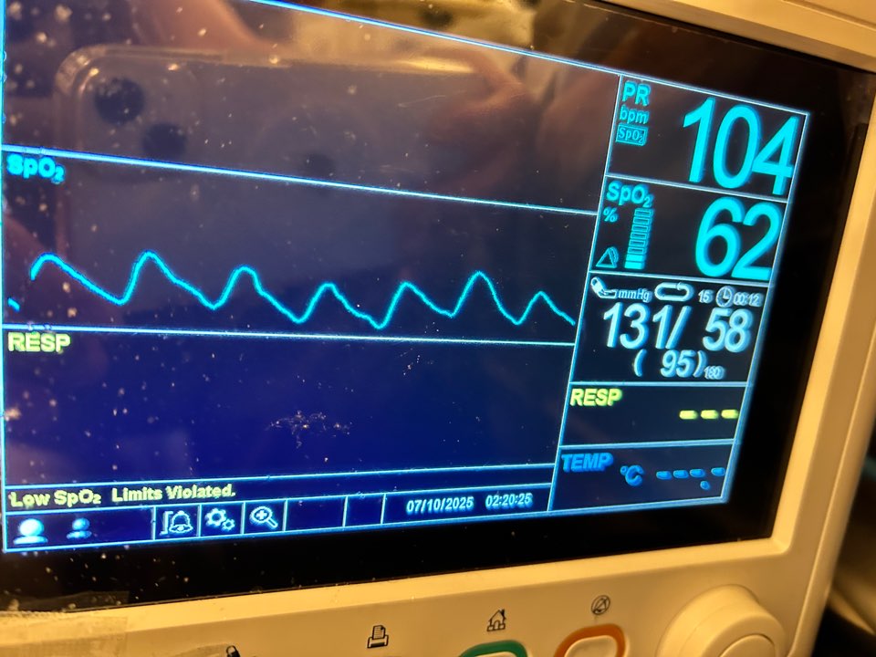 폐렴환자 런던에서 한국으로 이송완료