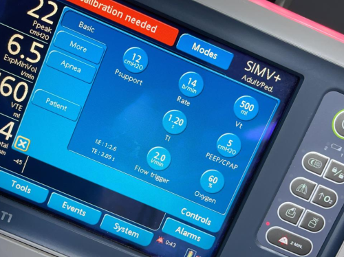 중국 광저우에서 뇌출혈 환자 해외환자이송