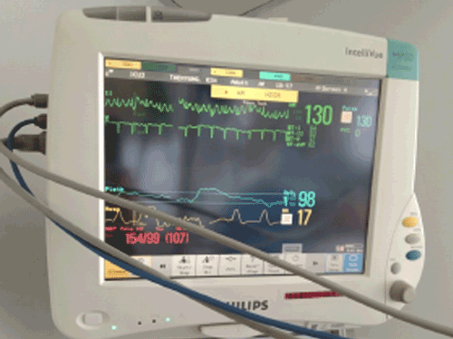 태국에서 60대 폐암환자 에어앰뷸런스 본국송환
