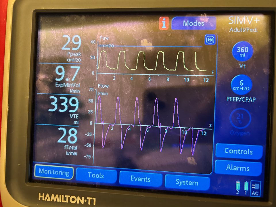 뇌출혈환자 중국에서 한국으로 이송완료